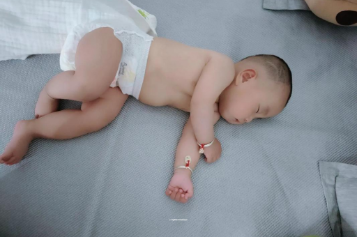 运城六个月宝宝眼睛散光
